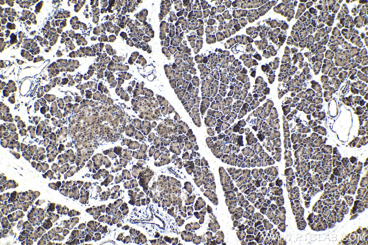 IHC staining of rat pancreas using 12050-1-AP