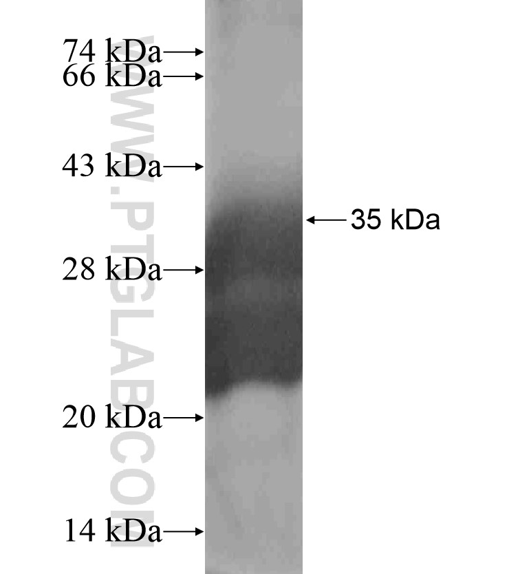 SLURP1 fusion protein Ag18457 SDS-PAGE SLURP1 fusion protein Ag18457 SDS-PAGE