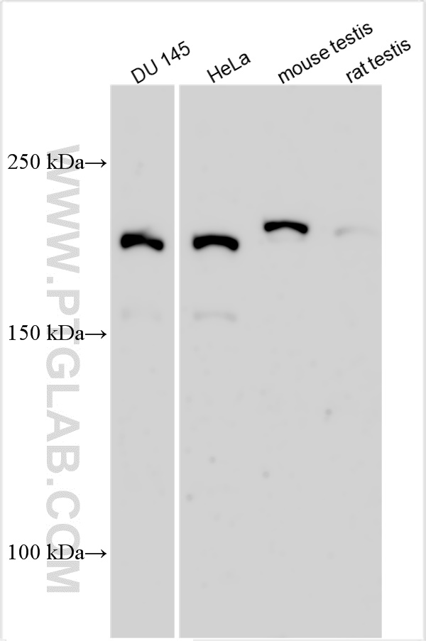 WB analysis using 31867-1-AP WB analysis using 31867-1-AP
