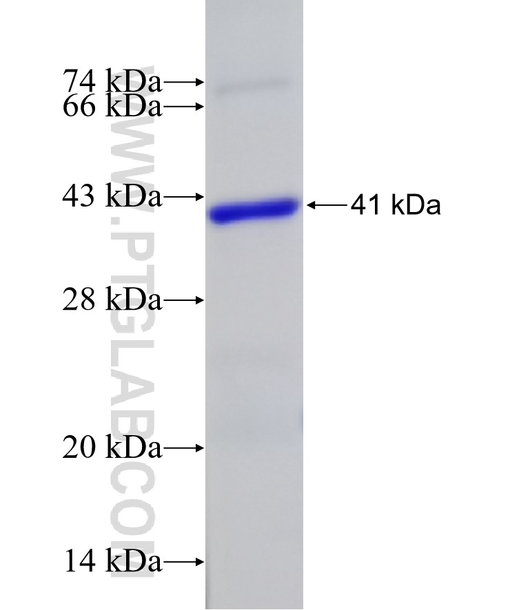 SLX4 fusion protein Ag32941 SDS-PAGE