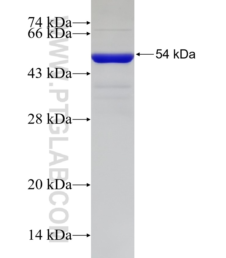 SLX4IP fusion protein Ag33034 SDS-PAGE SLX4IP fusion protein Ag33034 SDS-PAGE