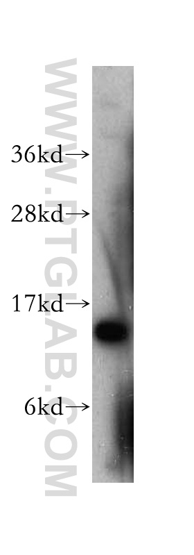 WB analysis of HeLa using 10318-1-AP