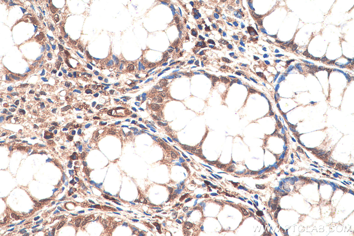 IHC staining of human colon using 10429-1-AP