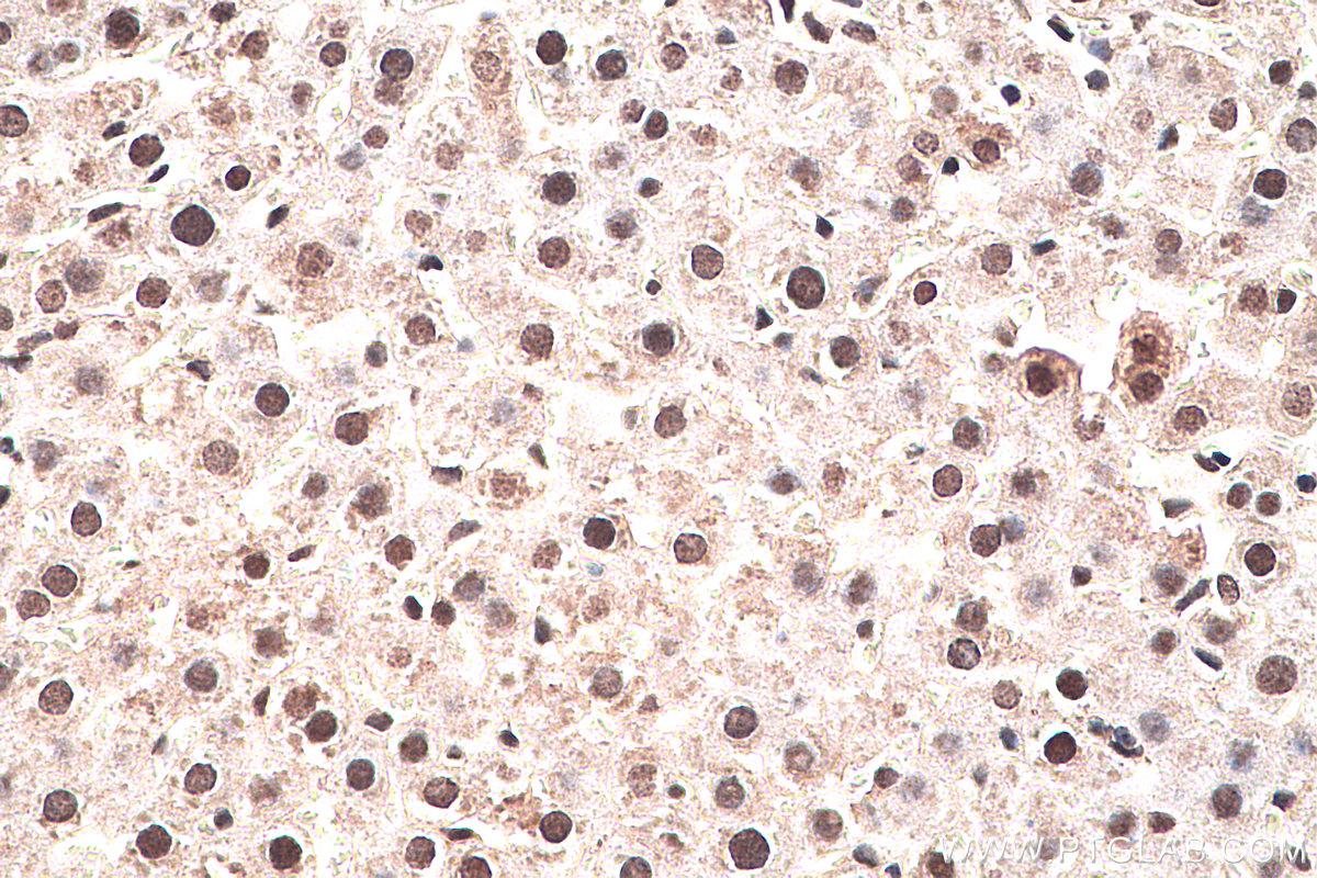 IHC staining of rat liver using 10429-1-AP