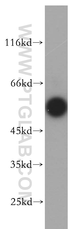 SMAD1 Polyclonal antibody