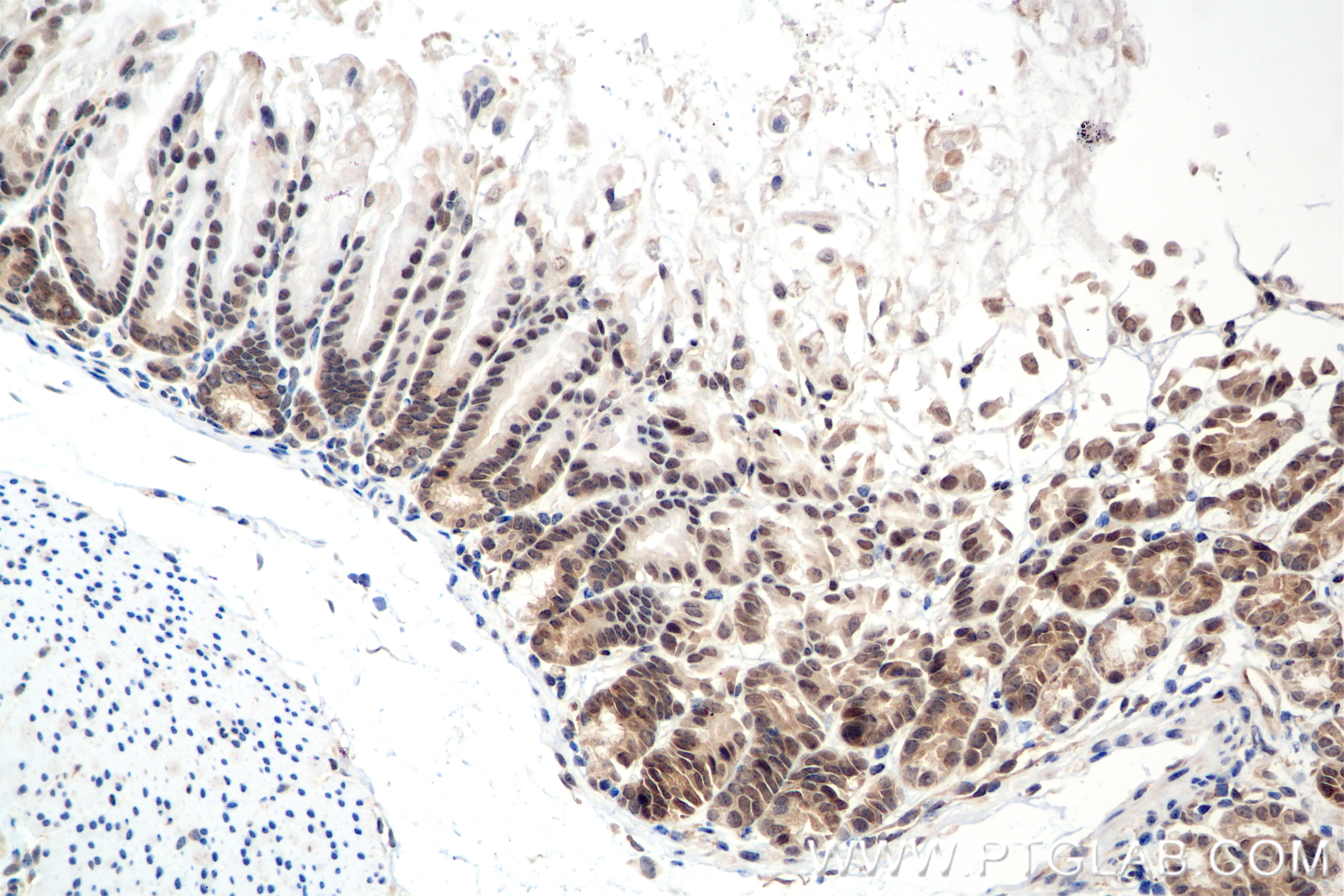 Immunohistochemical analysis of paraffin-embedded mouse stomach tissue slide using 85388-1-RR (SMAD1 antibody) at dilution of 1:500 (under 20x lens). Heat mediated antigen retrieval with Tris-EDTA buffer (pH 9.0). IHC staining of mouse stomach using 85388-1-RR