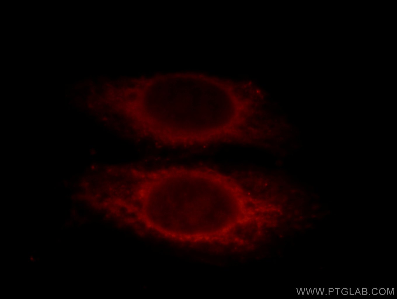 IF Staining of HepG2 using 12570-1-AP