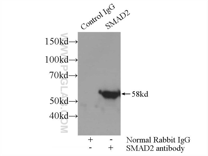 SMAD2 Polyclonal antibody
