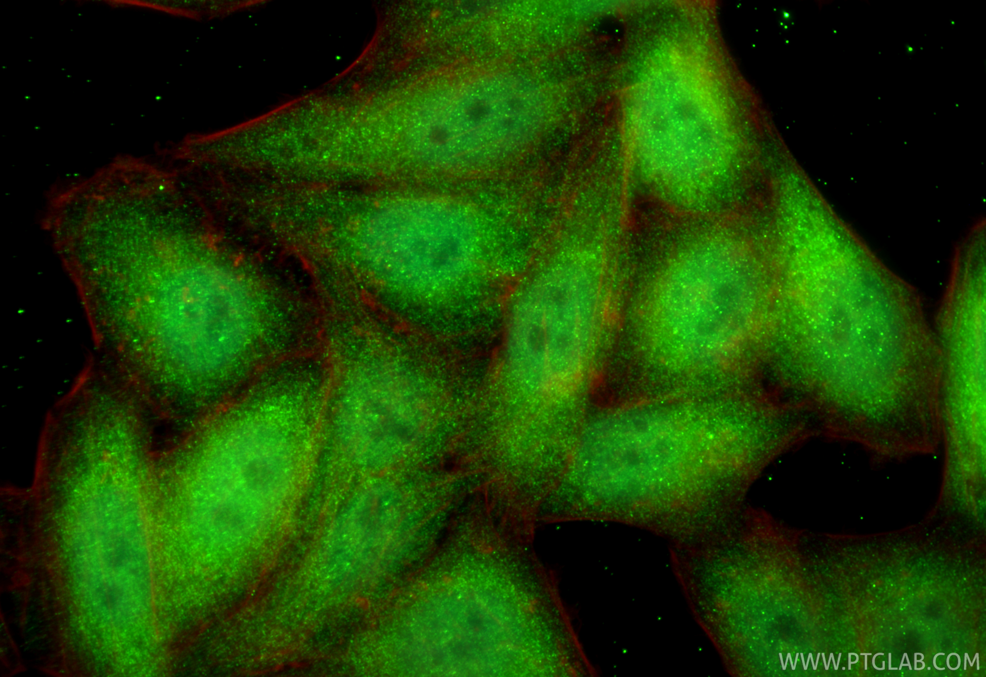 IF Staining of HepG2 using RMX00035 IF Staining of HepG2 using RMX00035