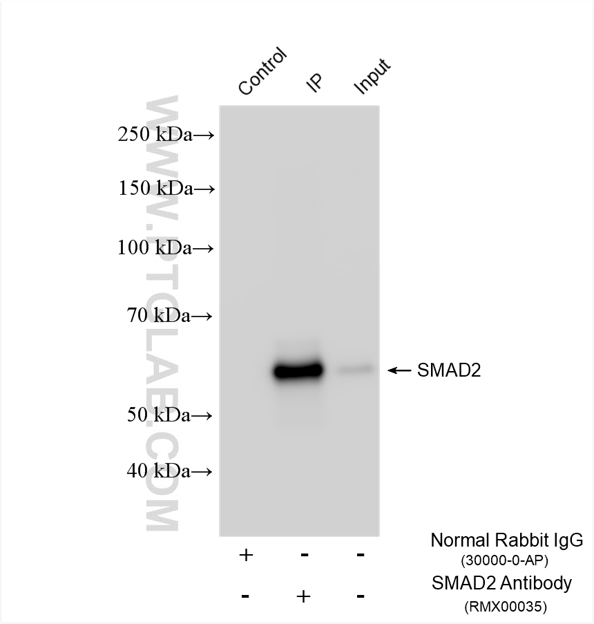 IP experiment of A549 using RMX00035 IP experiment of A549 using RMX00035