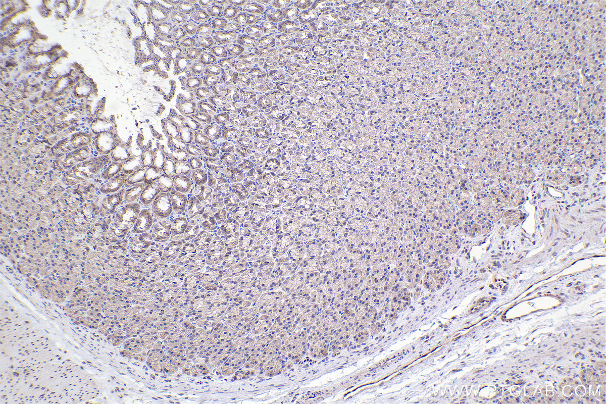 Immunohistochemical analysis of paraffin-embedded rat stomach tissue slide using 30130-1-AP (SMAD3 antibody) at dilution of 1:500 (under 10x lens). Heat mediated antigen retrieval with Tris-EDTA buffer (pH 9.0). IHC staining of rat stomach using 30130-1-AP
