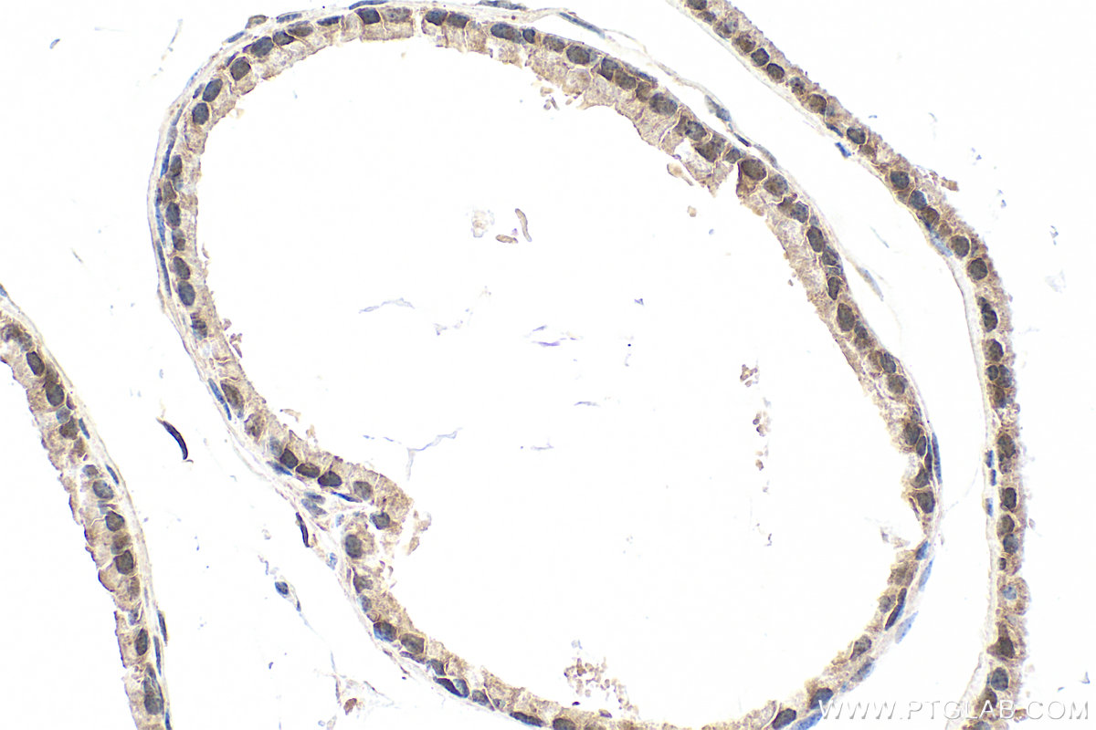 IHC staining of mouse prostate using 33480-1-AP IHC staining of mouse prostate using 33480-1-AP