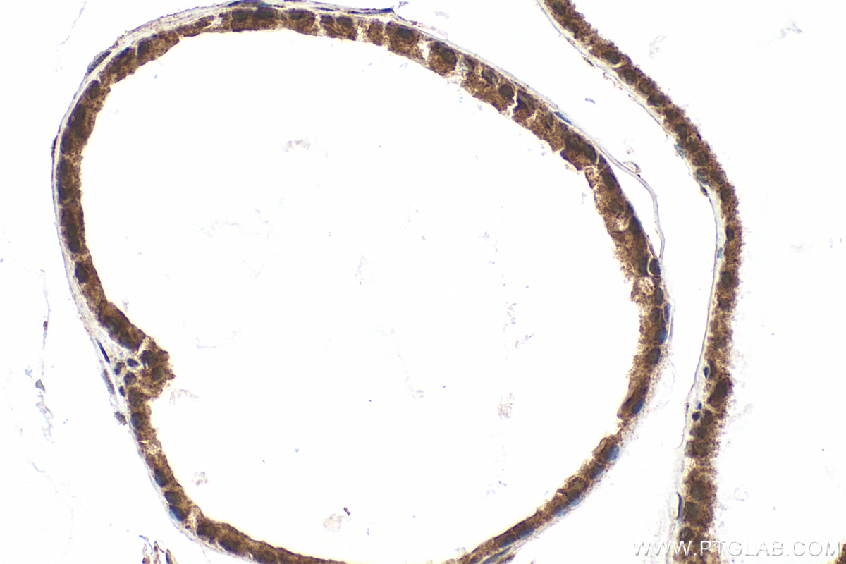 IHC staining of mouse prostate using 87035-1-RR (same clone as 87035-1-PBS)