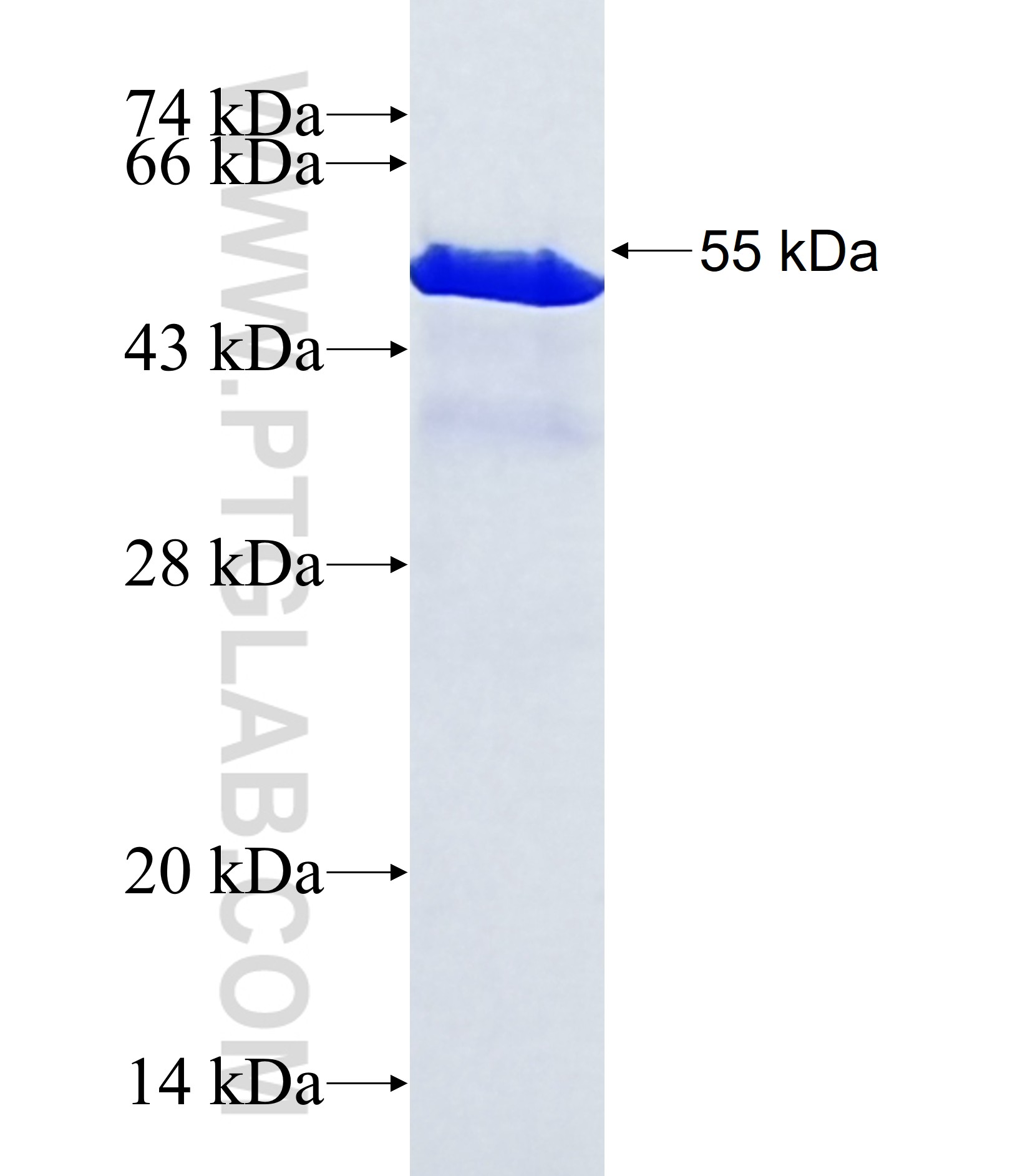 SMAD3 fusion protein Ag32623 SDS-PAGE SMAD3 fusion protein Ag32623 SDS-PAGE