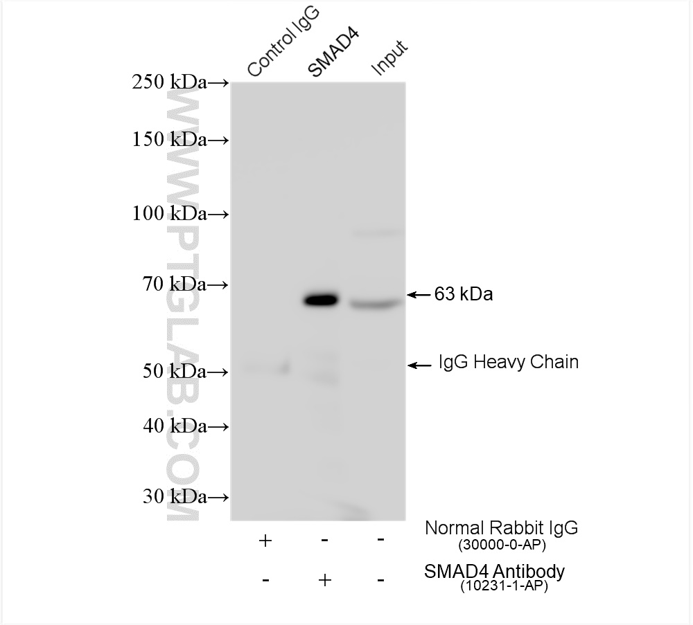 IP experiment of HeLa using 10231-1-AP