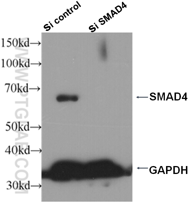 WB analysis of HepG2 cells using 51069-2-AP