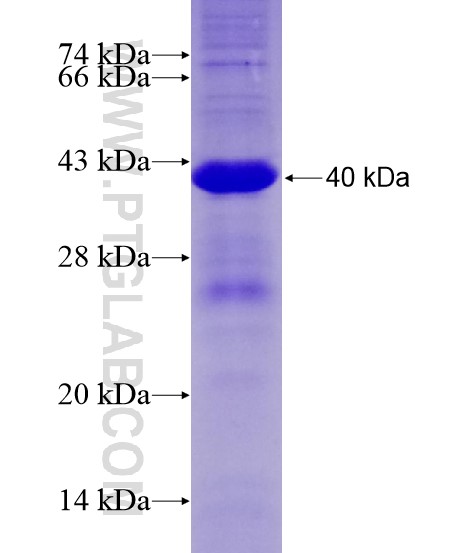 SMAD5 fusion protein Ag28699 SDS-PAGE