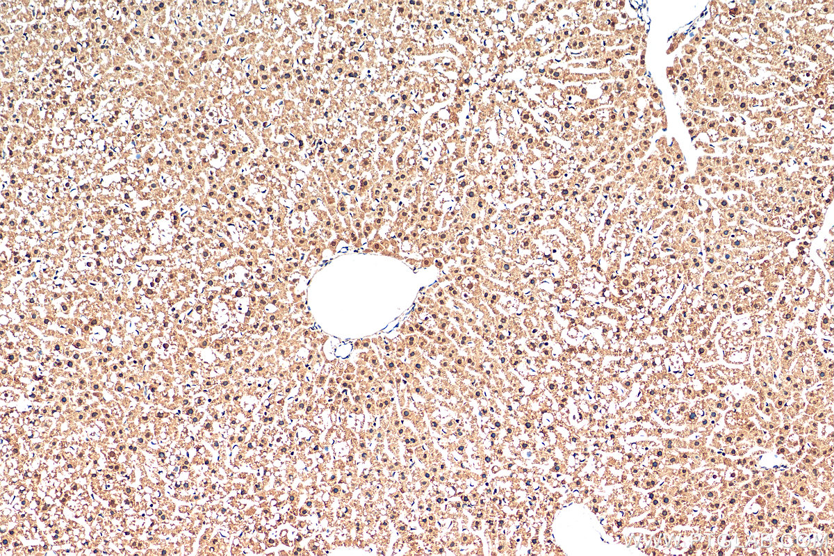 IHC staining of mouse liver using 25840-1-AP