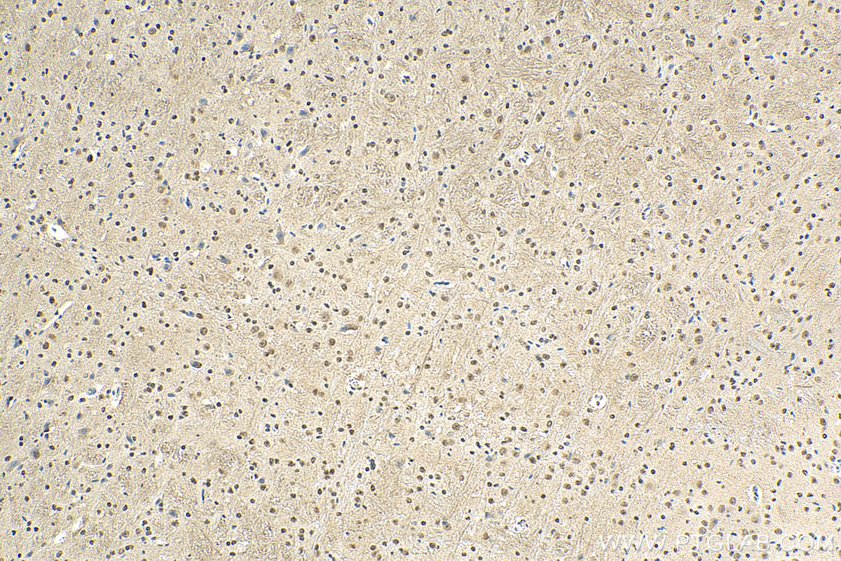 IHC staining of mouse cerebellum using 66478-1-Ig