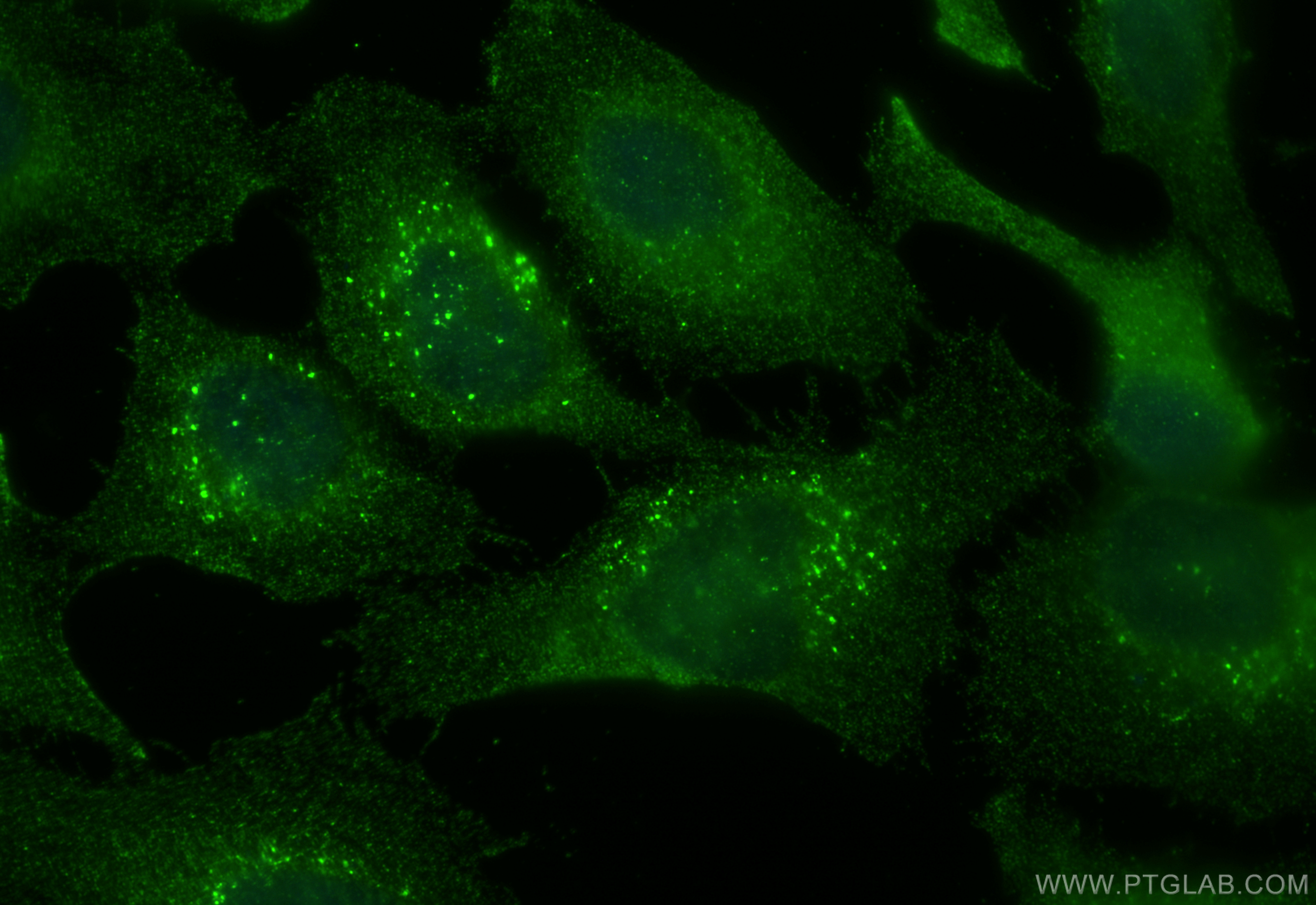 IF Staining of HeLa using 68594-1-Ig