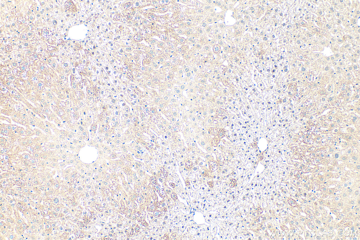 IHC staining of mouse liver using 80964-5-RR IHC staining of mouse liver using 80964-5-RR