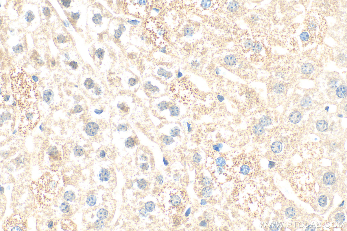 IHC staining of mouse liver using 80964-5-RR IHC staining of mouse liver using 80964-5-RR