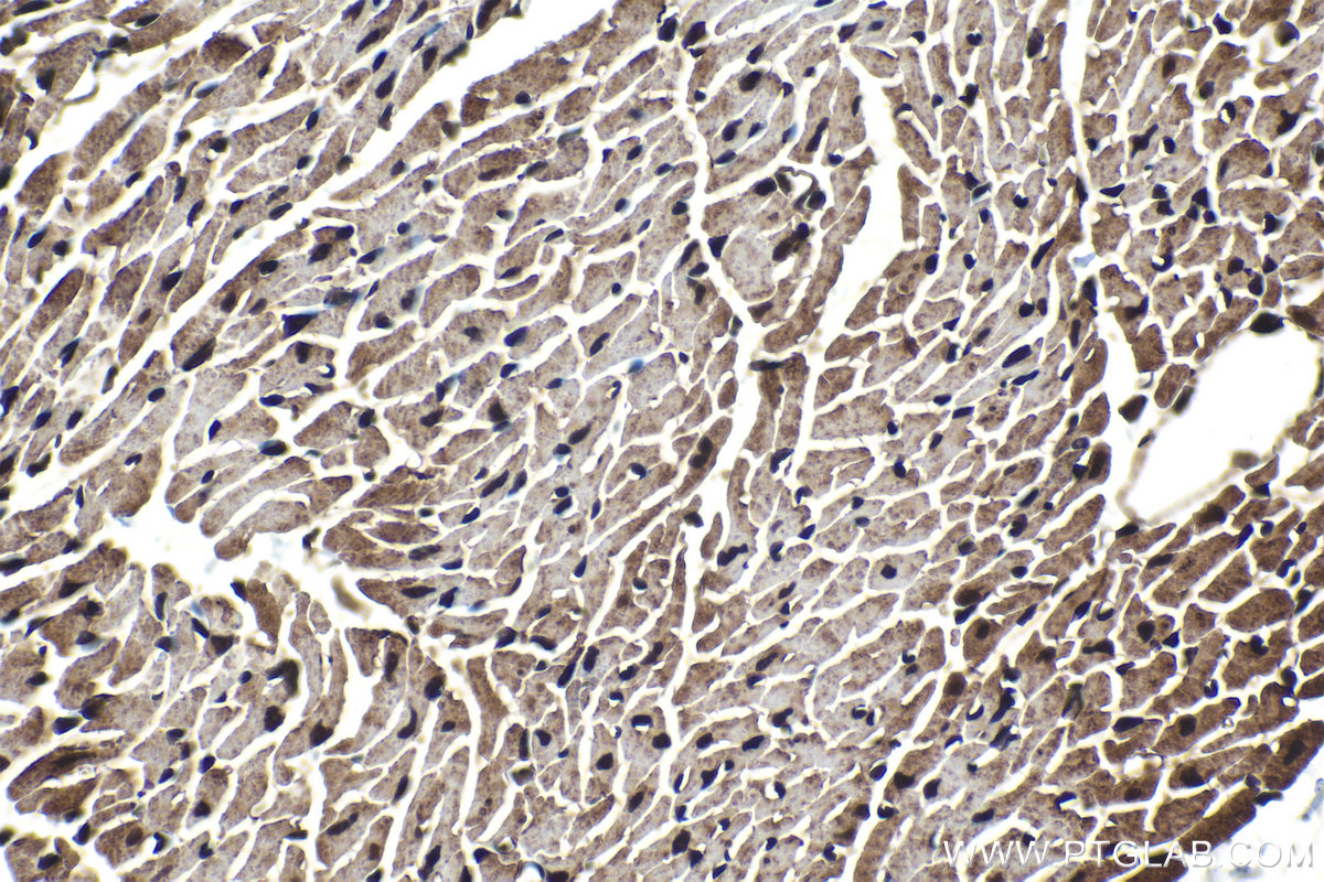 Immunohistochemical analysis of paraffin-embedded mouse heart tissue slide using 16397-1-AP (SMAD9 antibody) at dilution of 1:200 (under 40x lens). Heat mediated antigen retrieval with Tris-EDTA buffer (pH 9.0). IHC staining of mouse heart using 16397-1-AP