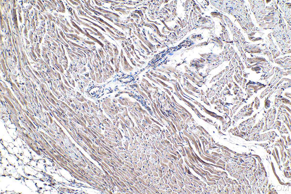 Immunohistochemical analysis of paraffin-embedded rat heart tissue slide using 16397-1-AP (SMAD9 antibody) at dilution of 1:200 (under 10x lens). Heat mediated antigen retrieval with Tris-EDTA buffer (pH 9.0). IHC staining of rat heart using 16397-1-AP