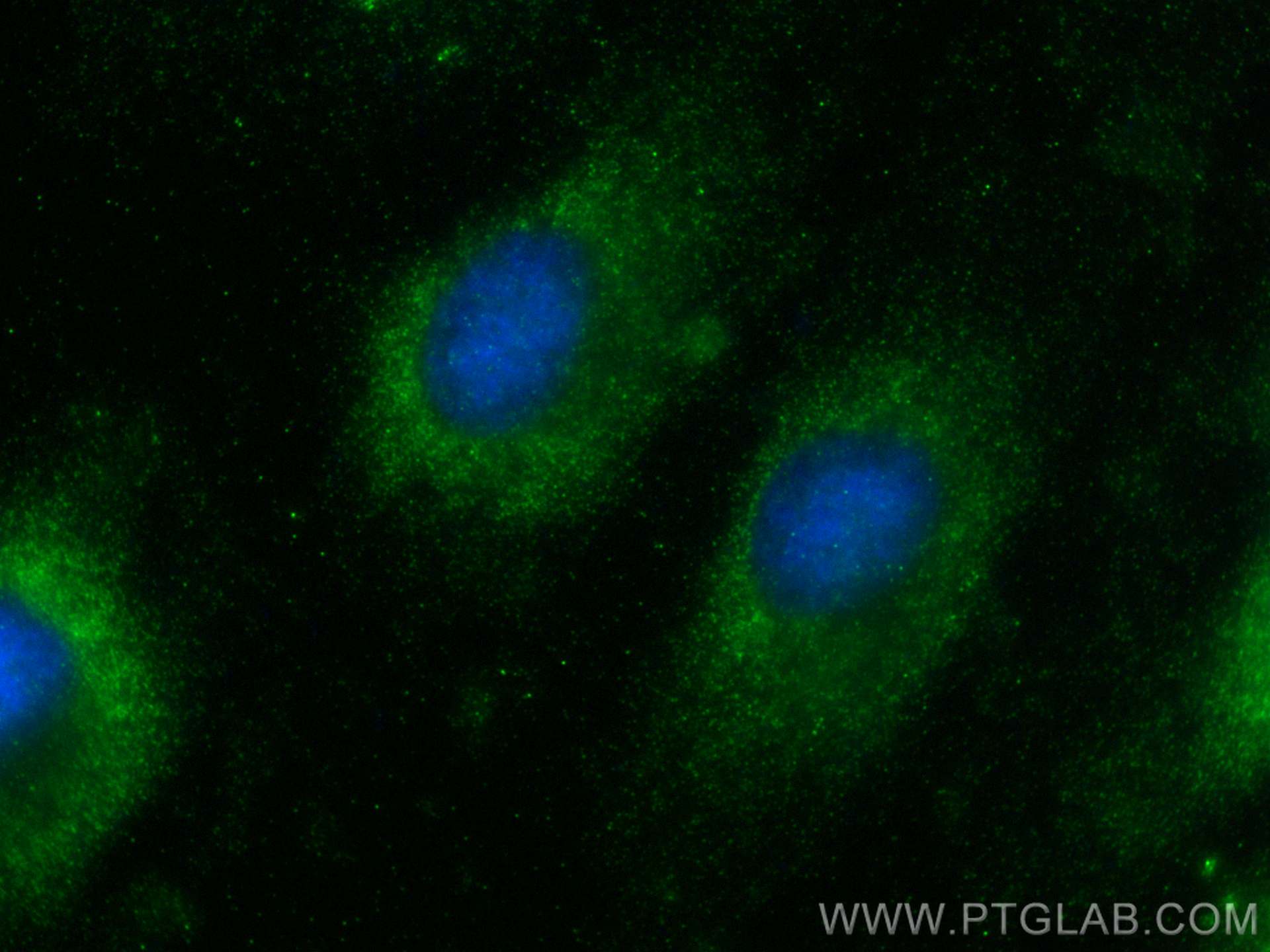 IF Staining of HeLa using 30910-1-AP