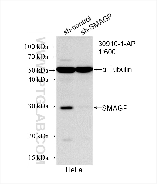 WB analysis of HeLa using 30910-1-AP