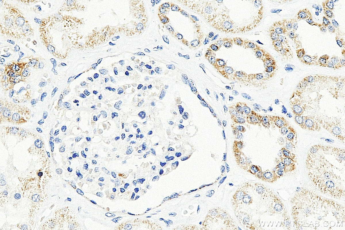 IHC staining of human kidney using 12799-1-AP IHC staining of human kidney using 12799-1-AP