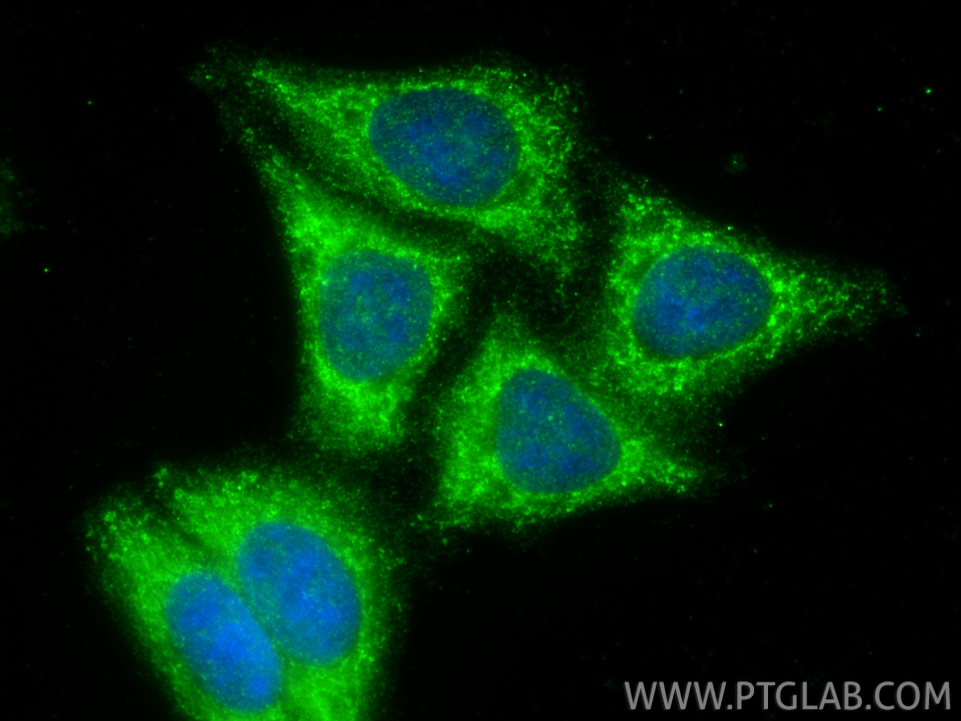 Immunofluorescent analysis of (-20°C Ethanol) fixed HepG2 cells using SMAP2 antibody (16597-1-AP) at dilution of 1:400 and CoraLite®488-Conjugated Goat Anti-Rabbit IgG(H+L) (<a class='green' href='/productredirect?CatalogNo=SA00013-2' target='_blank'>SA00013-2</a>). IF Staining of HepG2 using 16597-1-AP