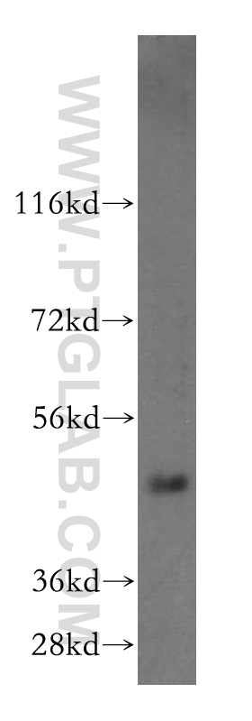 WB analysis of human liver using 16597-1-AP