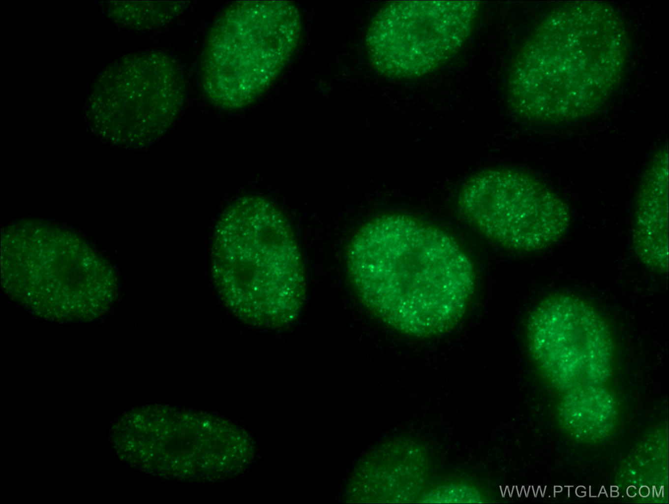 IF Staining of HepG2 using 26613-1-AP