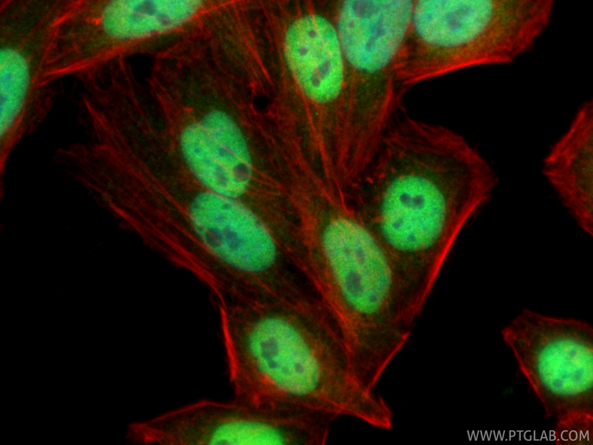IF Staining of HepG2 using 26613-1-AP