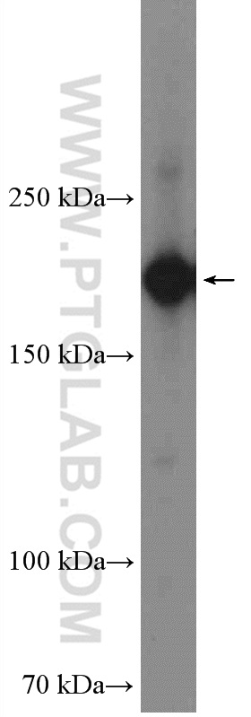 WB analysis of HeLa using 26613-1-AP