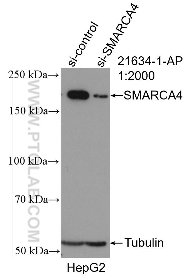 WB analysis of HepG2 using 21634-1-AP