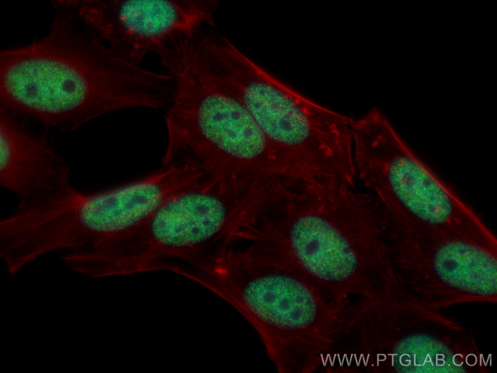 IF Staining of HepG2 using 66561-1-Ig (same clone as 66561-1-PBS)