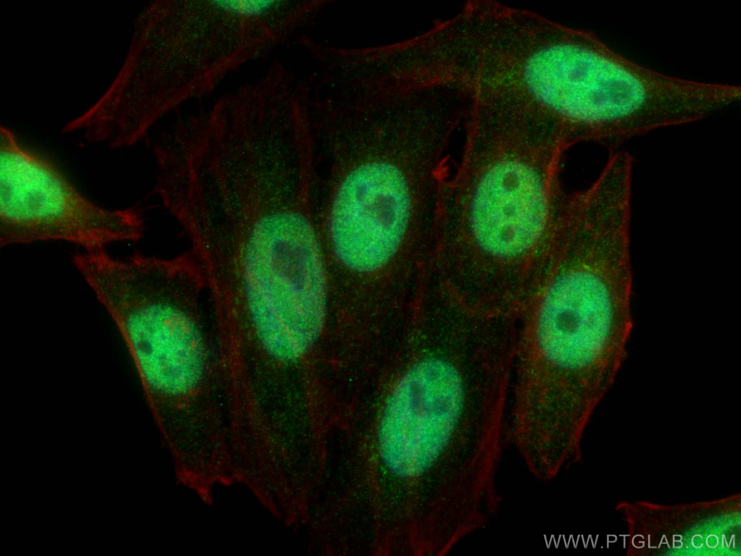 IF Staining of HepG2 using 66561-1-Ig (same clone as 66561-1-PBS)