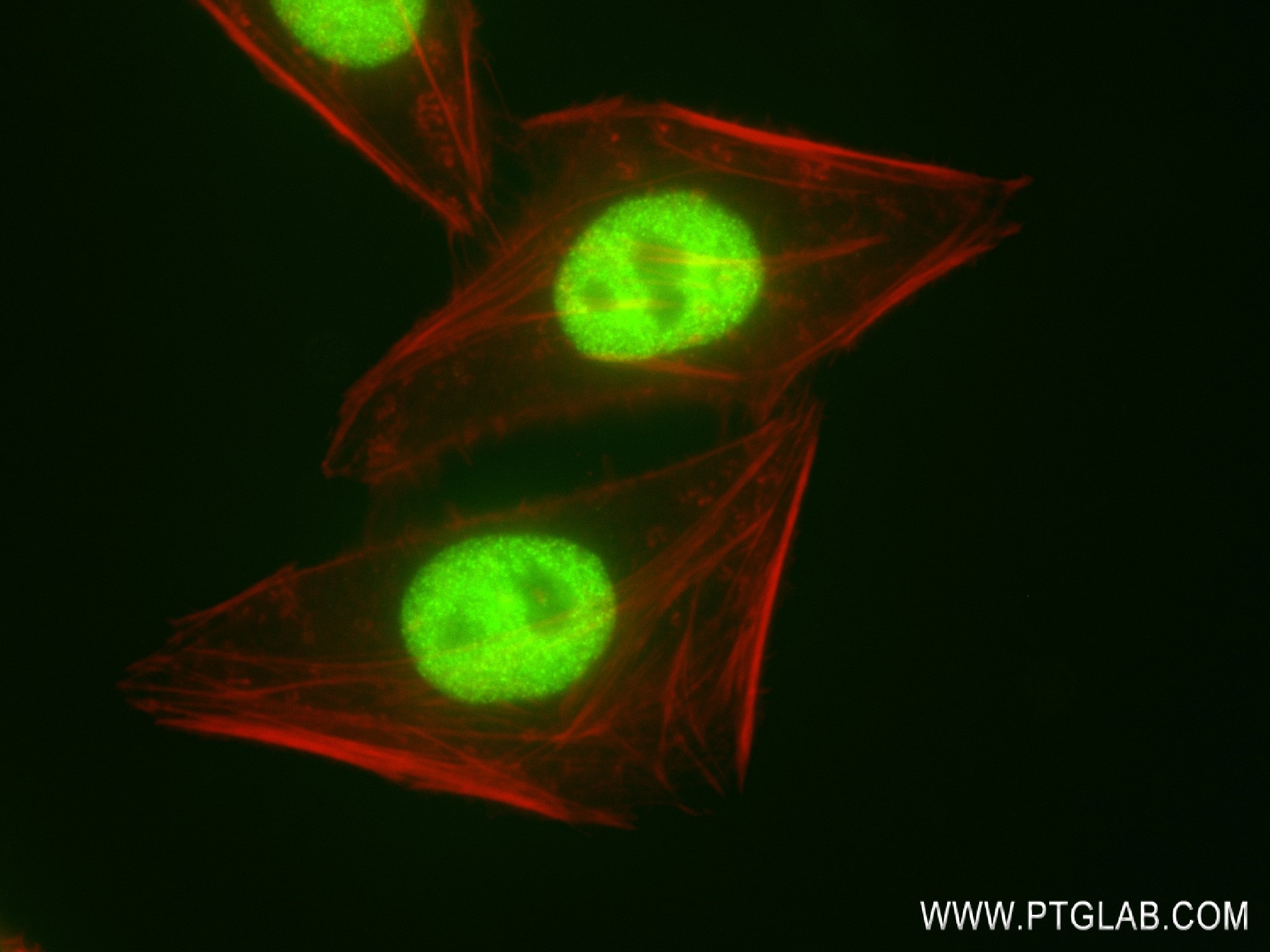 IF Staining of HepG2 using 83310-2-RR (same clone as 83310-2-PBS)