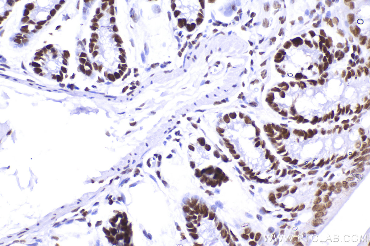 IHC staining of mouse colon using 83310-2-RR (same clone as 83310-2-PBS)