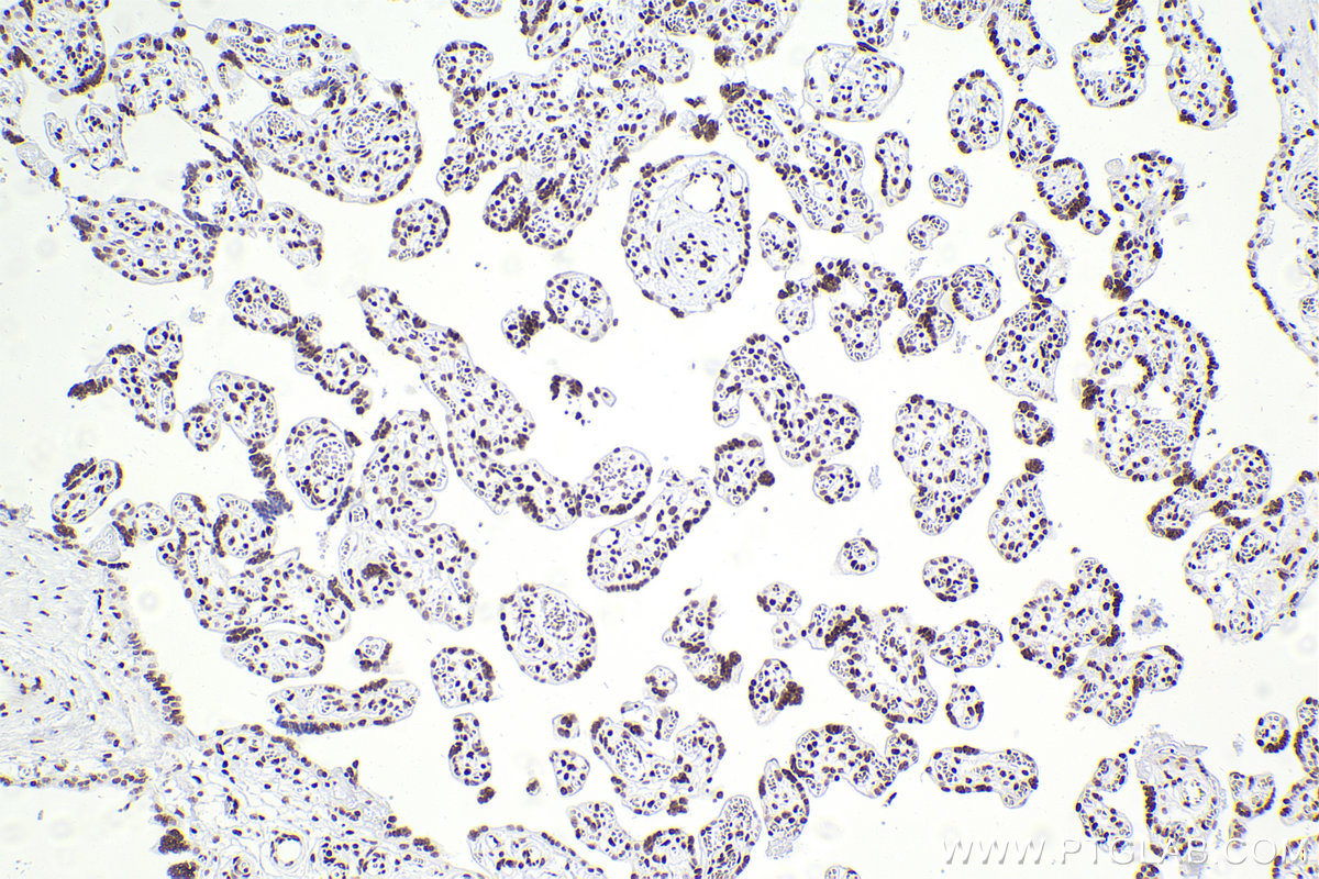 IHC staining of human placenta using 83310-2-RR (same clone as 83310-2-PBS)