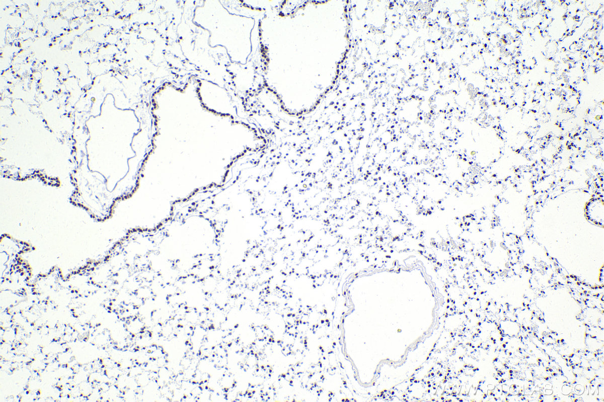 IHC staining of mouse lung using 83310-2-RR (same clone as 83310-2-PBS)