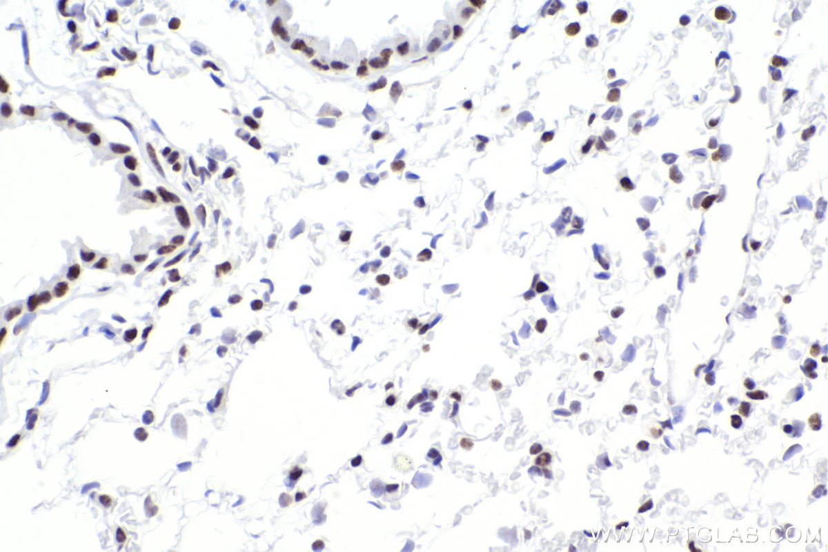 IHC staining of mouse lung using 83310-2-RR (same clone as 83310-2-PBS)