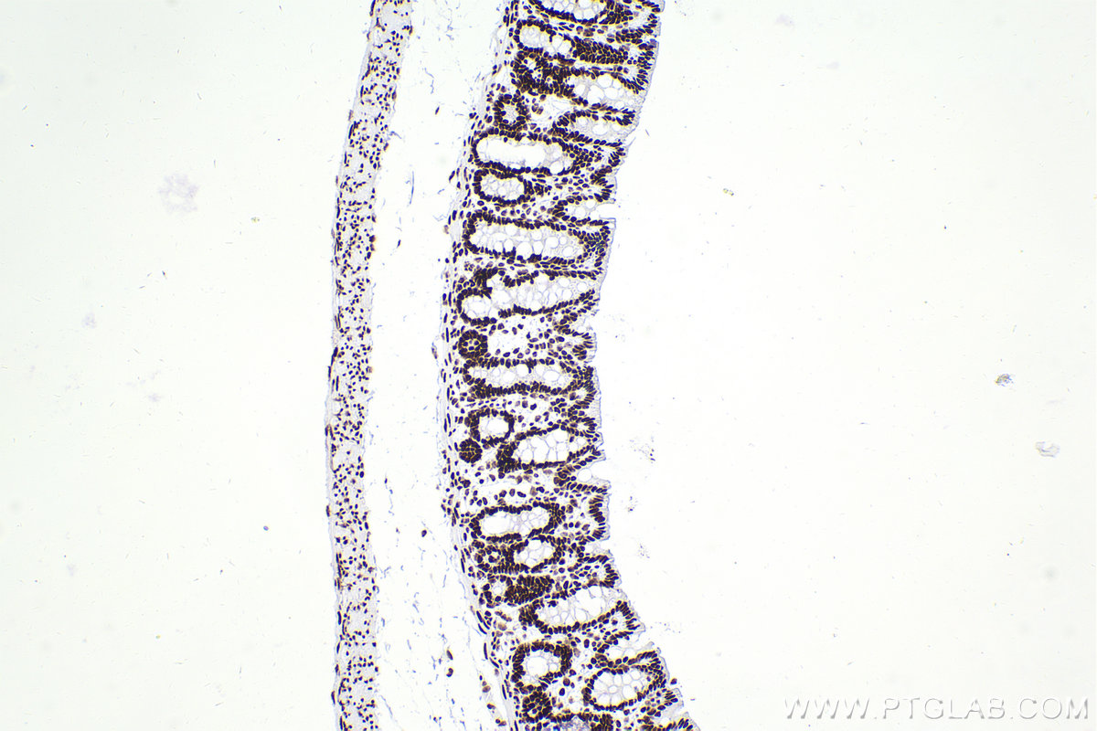 IHC staining of rat colon using 83310-2-RR (same clone as 83310-2-PBS)