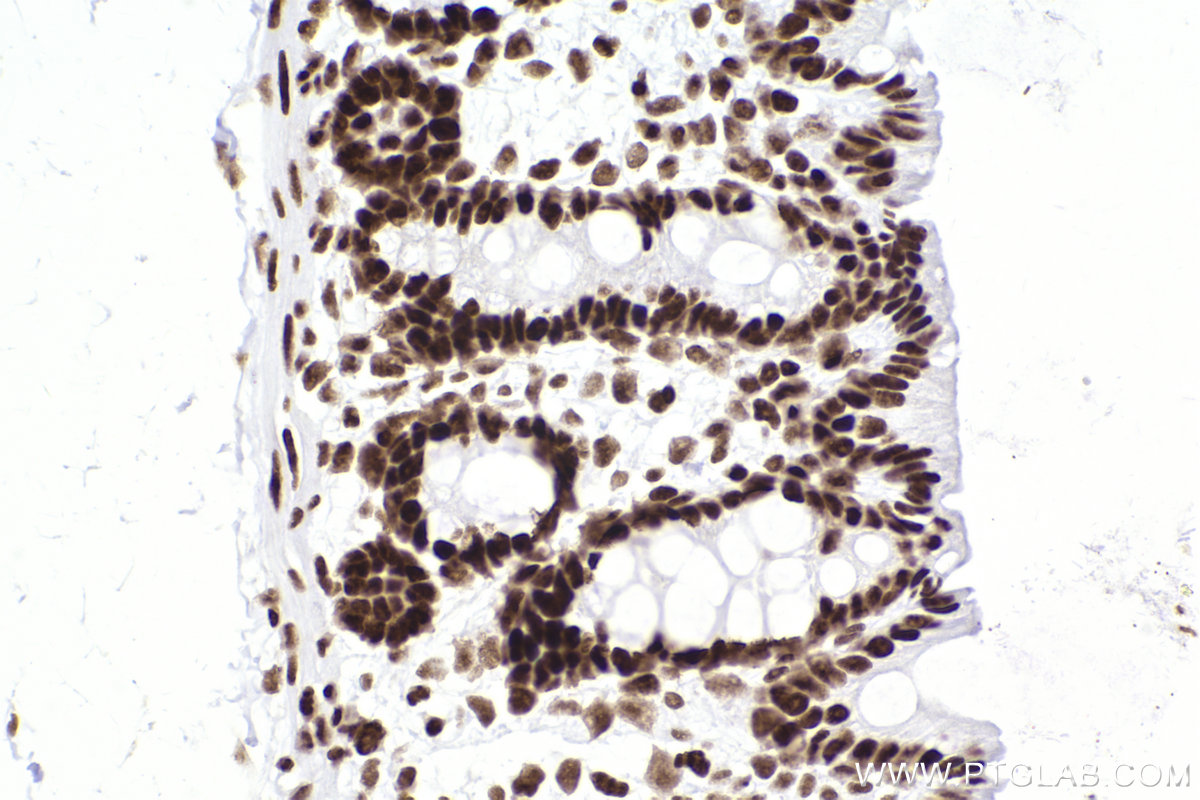 IHC staining of rat colon using 83310-2-RR (same clone as 83310-2-PBS)