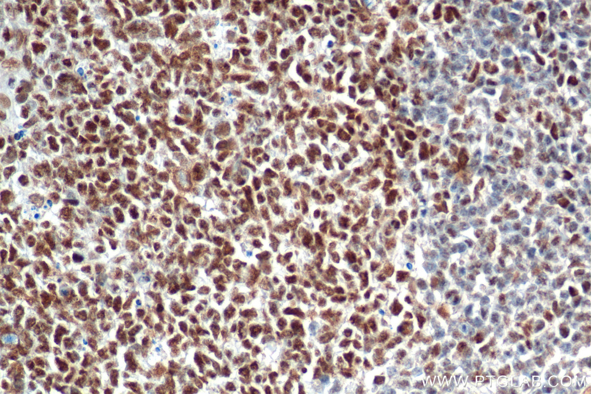 IHC staining of human tonsillitis using 83310-2-RR (same clone as 83310-2-PBS)
