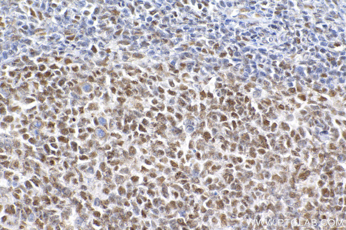 IHC staining of human tonsillitis using 83310-7-RR (same clone as 83310-7-PBS)