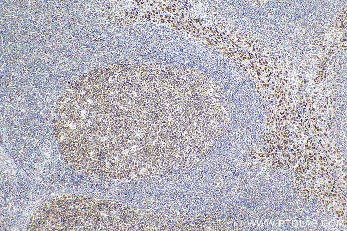 IHC staining of human tonsillitis using 83310-7-RR (same clone as 83310-7-PBS)