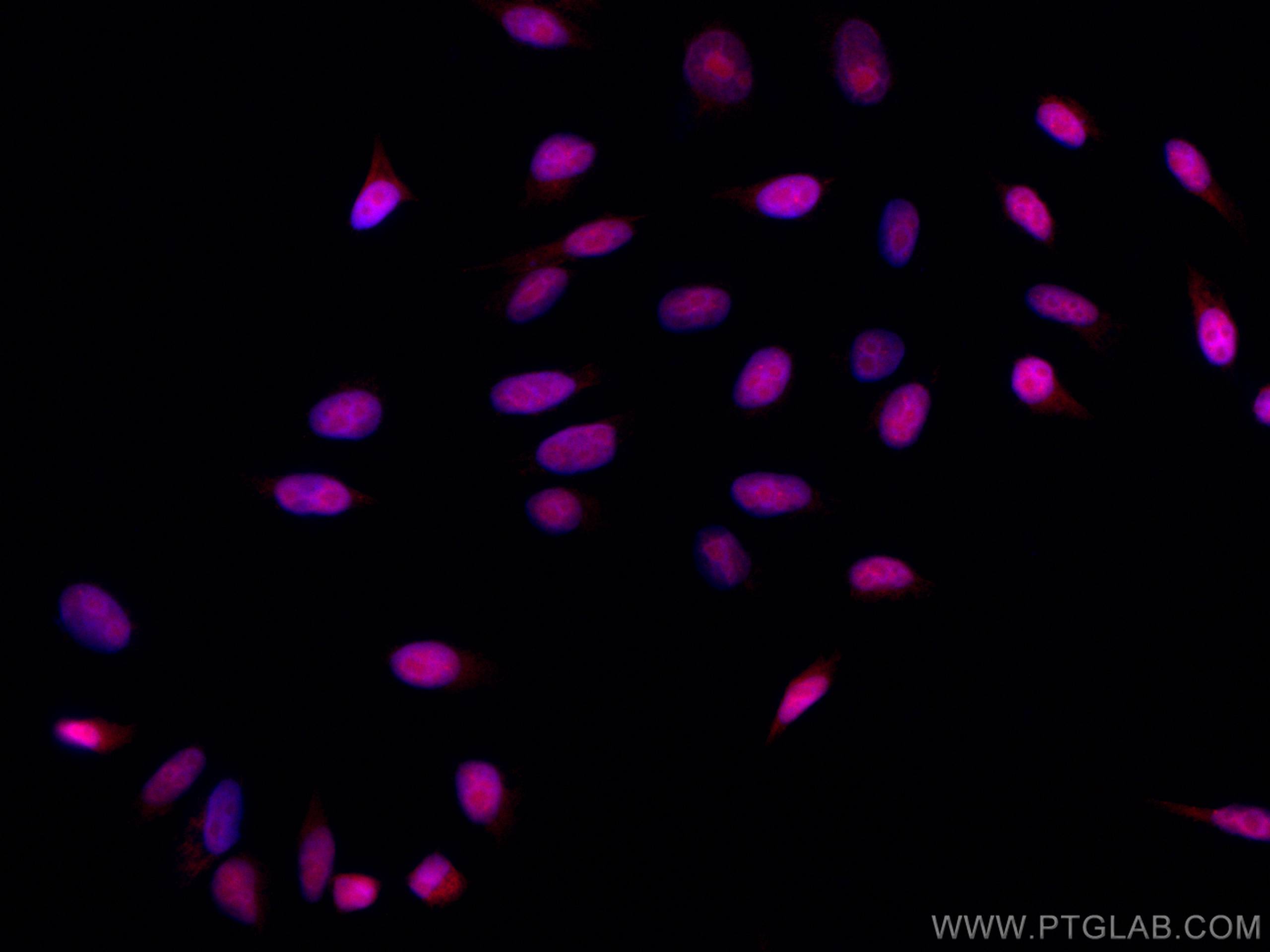 IF Staining of HepG2 using CL594-66561